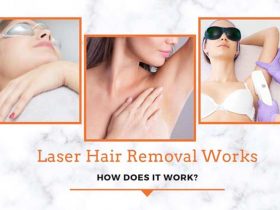 Laser Hair Removal Works – How Does It Work?