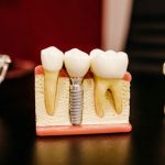 How to Choose an Orthodontist for My Braces?