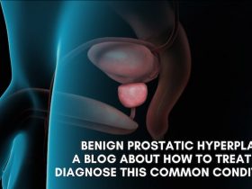 Benign prostatic hyperplasia: A blog about how to treat and diagnose this common condition