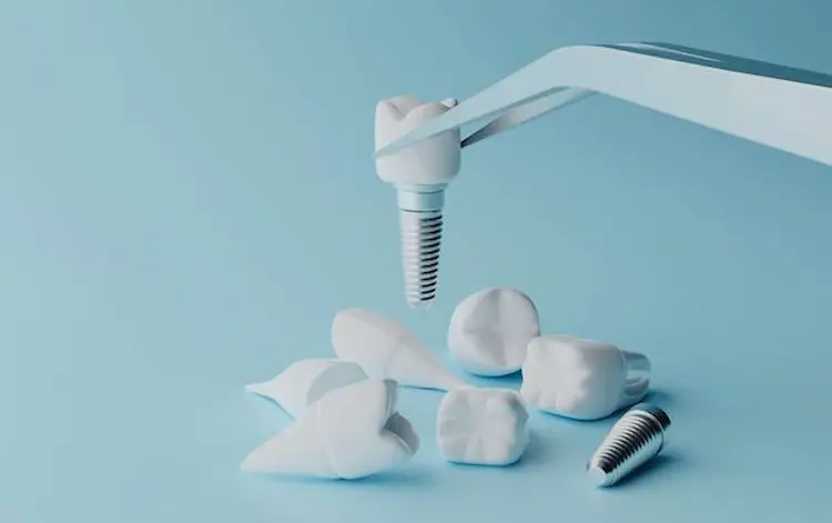 Dental Implants - A Path To Better Health
